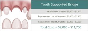 The Cost of Dental Implants at Temecula Facial Oral Surgery