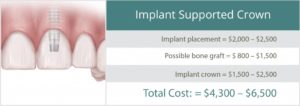 The Breakdown in Cost of Dental Implants at Temecula Facial Oral Surgery