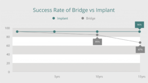 The Success Rate Bridge vs Implant