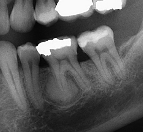 Another unusual pathology case | Dr. Dmitry Tsvetov