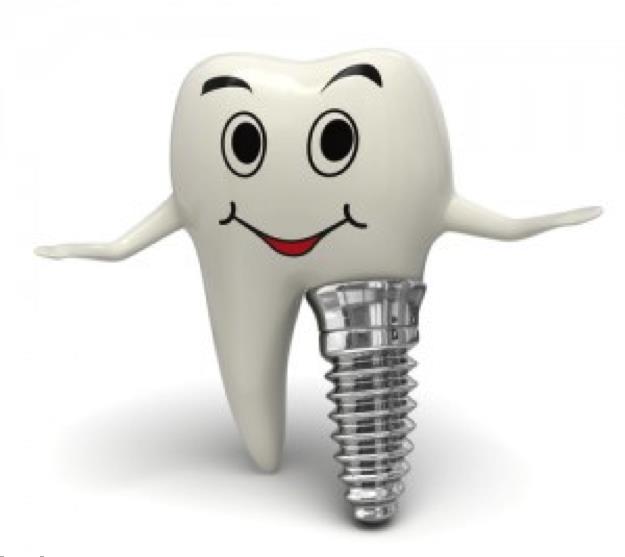 Dental Implant Caricature B