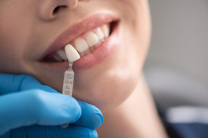 How long do dental implants take to heal