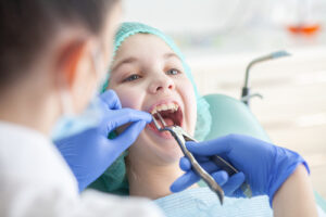 Which premolars are extracted for orthodontic reasons