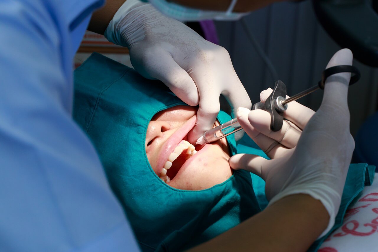 recovery from an emergency tooth extraction