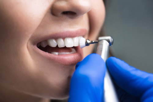 What are the tools you should use to clean dental implants