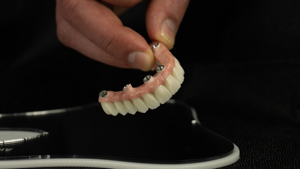 What are Top 3 Materials for All-on-4-dentures in Rancho Bernardo