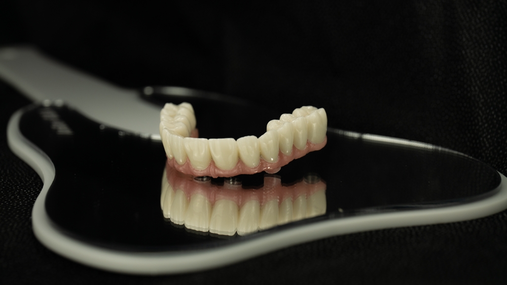 What causes All-on-4 dental implant failure